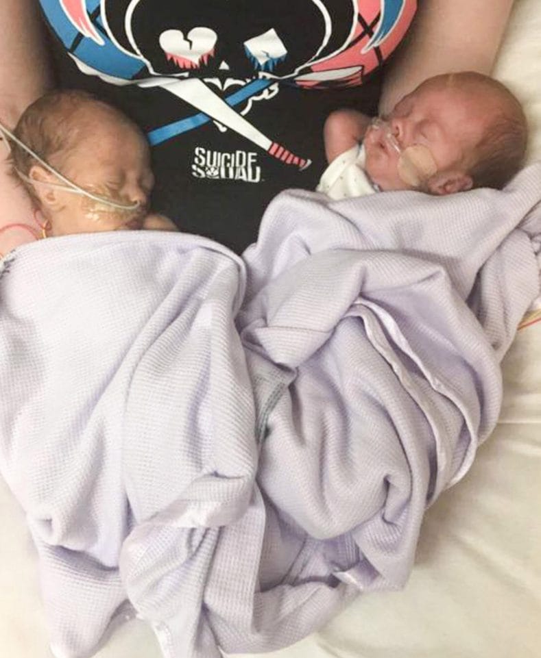 “miracle twins” born after the abortion limit 