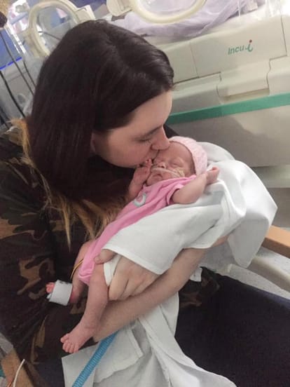 “miracle twins” born after the abortion limit 