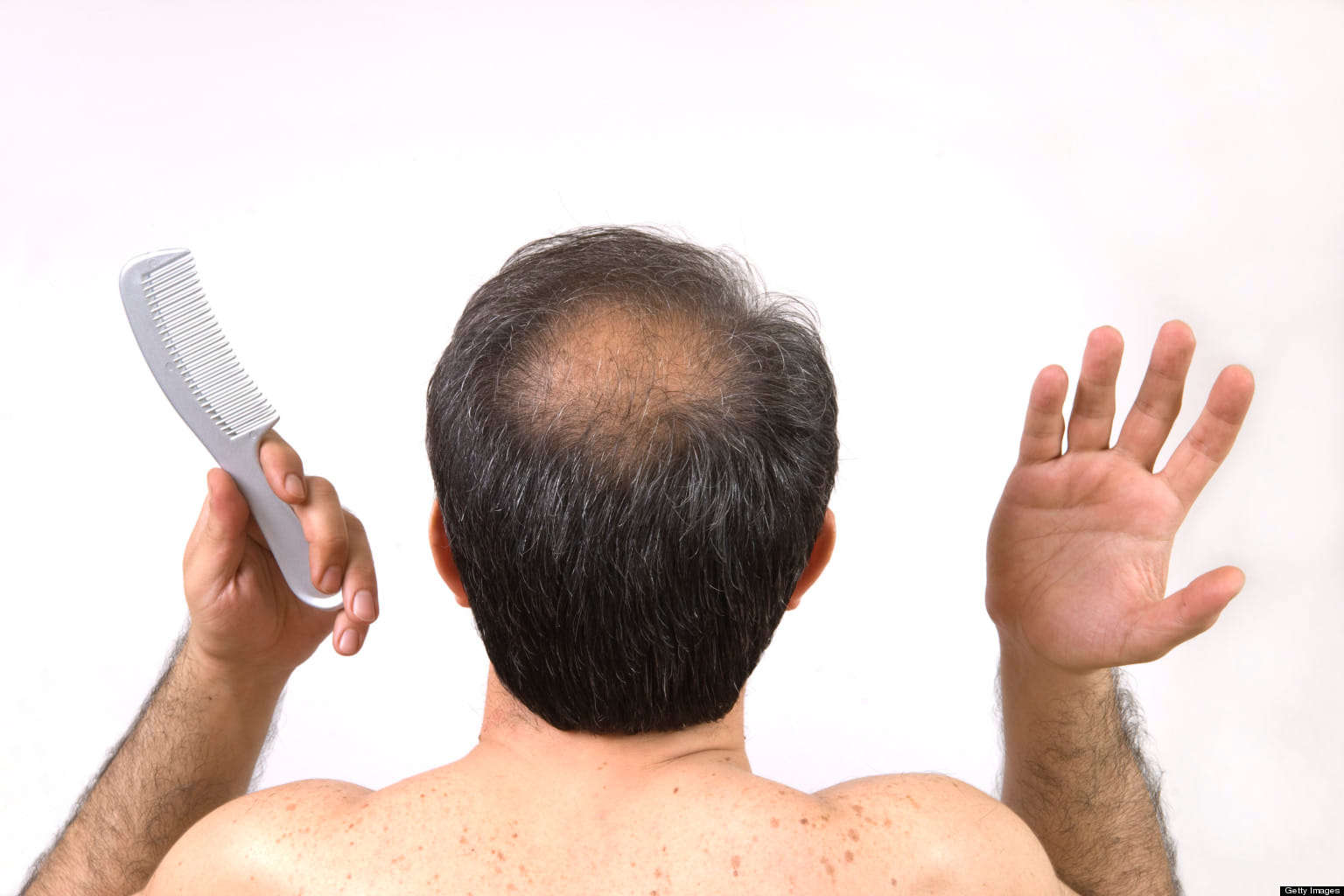 hair loss and balding can cure by this Tibetan method