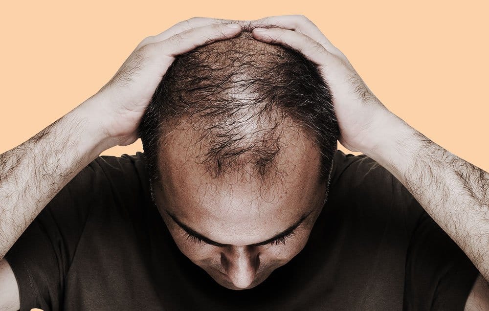 hair loss and balding can cure by this Tibetan method