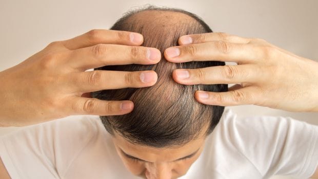 hair loss and balding can cure by this Tibetan method
