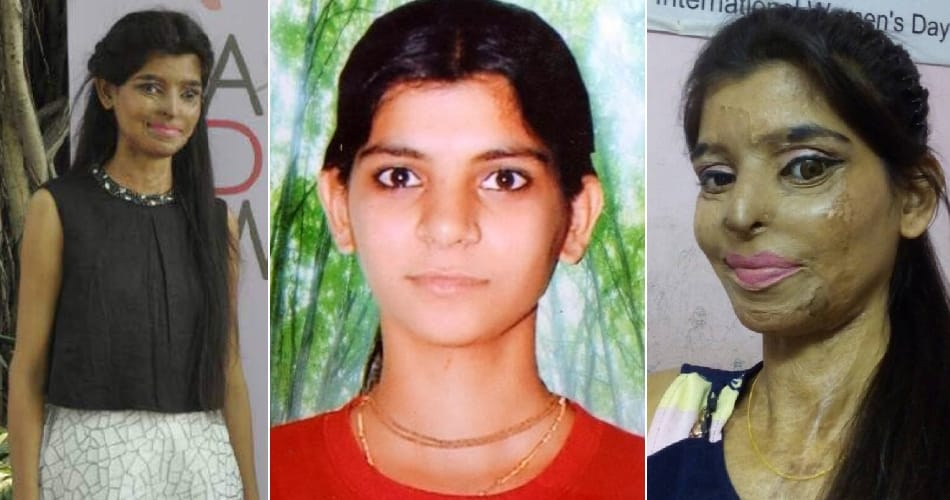 acid attack victim national player ritu saini story