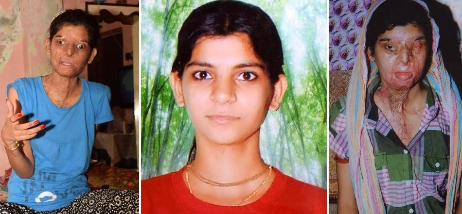 acid attack victim national player ritu saini story