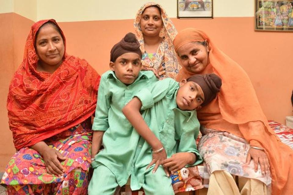 miracle of god, Conjoined twins Sohna Mohna at Pingalwara punjab