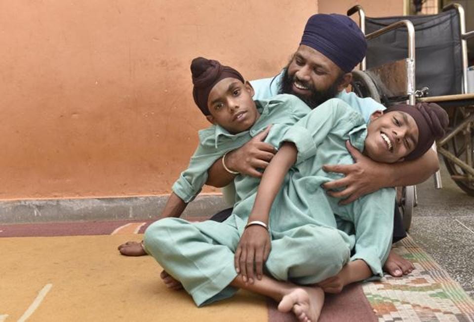 miracle of god, Conjoined twins Sohna Mohna at Pingalwara punjab