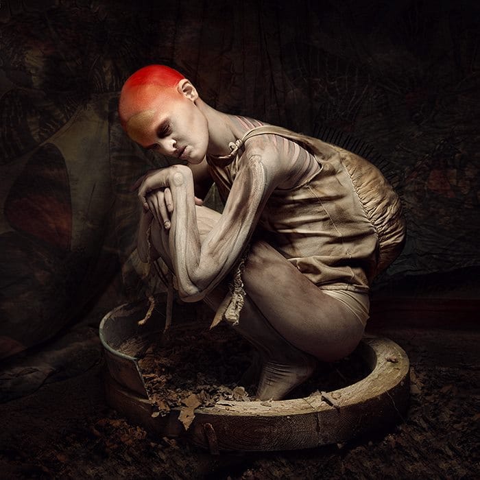  Melanie Gaydos, Model With A Rare Genetic Disorder 