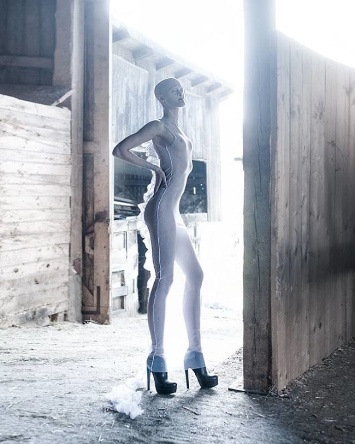  Melanie Gaydos, Model With A Rare Genetic Disorder 