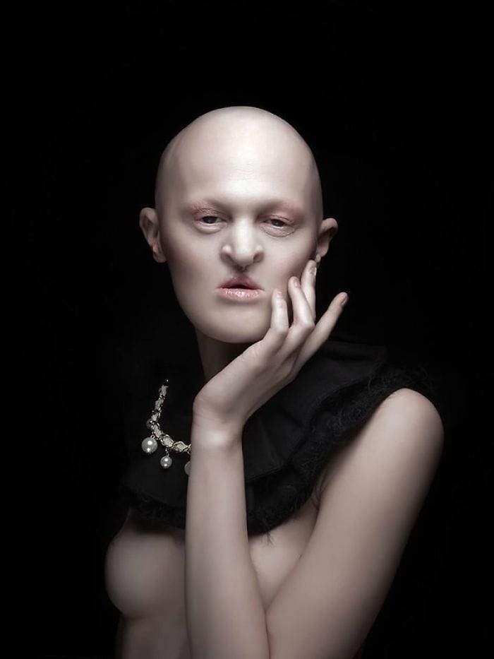  Melanie Gaydos, Model With A Rare Genetic Disorder 