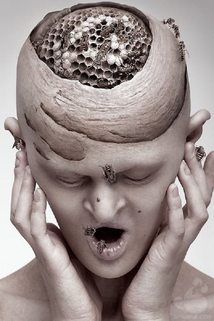  Melanie Gaydos, Model With A Rare Genetic Disorder 