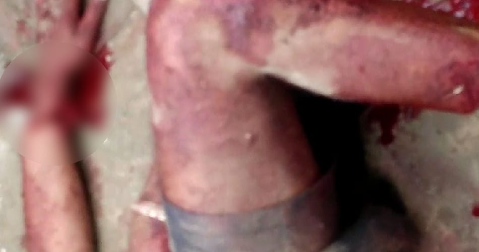 Villagers cut man's hands and feet, punjab bathinda news