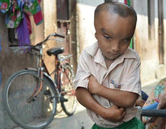 miracle of god pranshu, jalandhar boy
