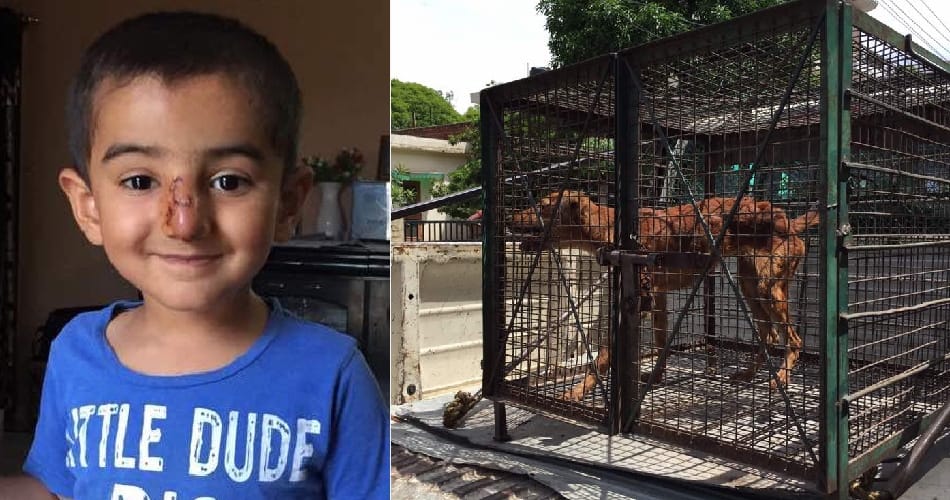 dog bites on innocent child nose, mohali news