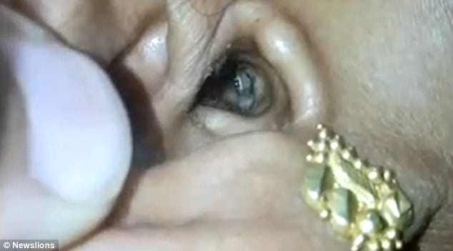 spider crawls out of woman’s EAR 