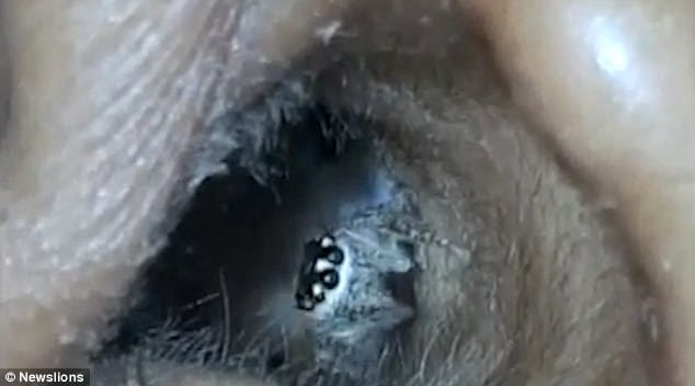 spider crawls out of woman’s EAR 
