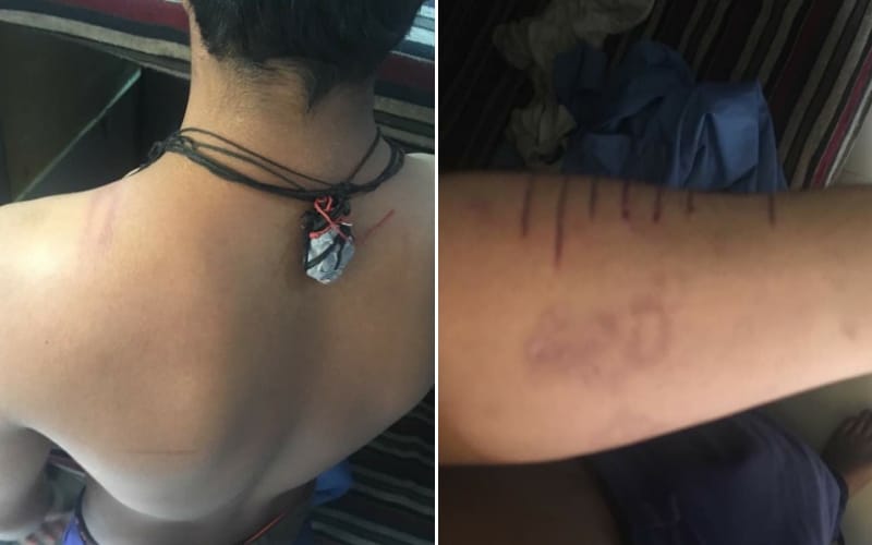 children brutally beaten in lucknow observation home 