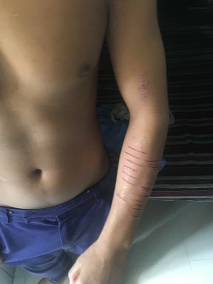 children brutally beaten in lucknow observation home 