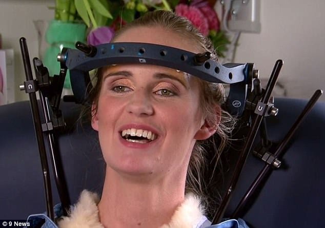 Melbourne woman breaks her neck by laughing 