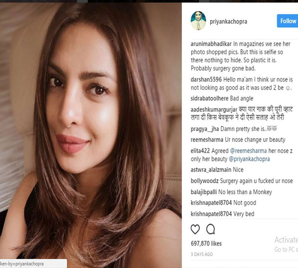 social media user troll priyanka chopra for her nose job