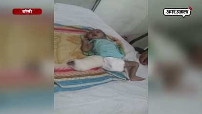 BAREILY DOCTORS MISTREAT BABY GIRL, LOSES LEGS