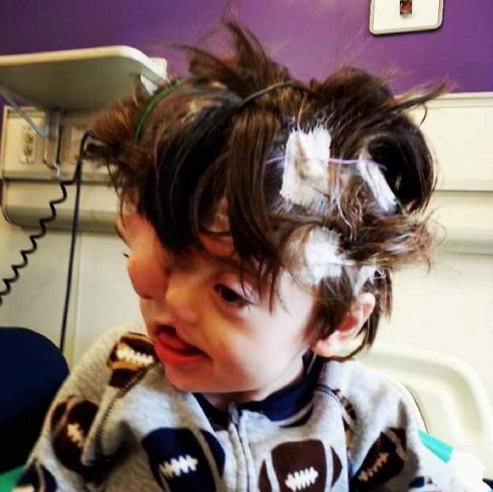 boy born with faces celebrates his 13 birthday