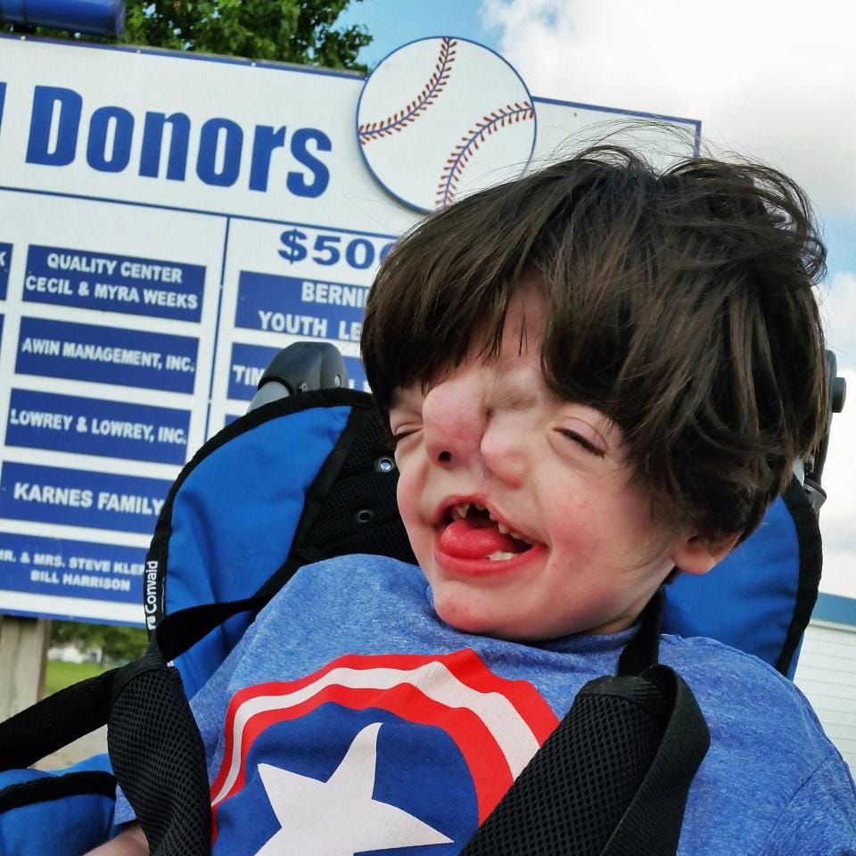 boy born with faces celebrates his 13 birthday