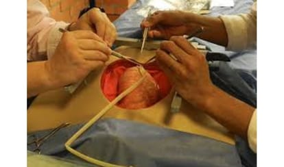 four month Pakistani boy suffering from heart ailment will get a fresh lease in noida