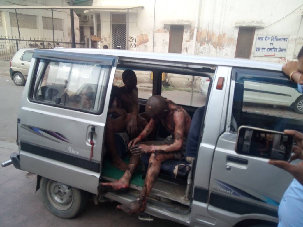 eight labour burned from fire