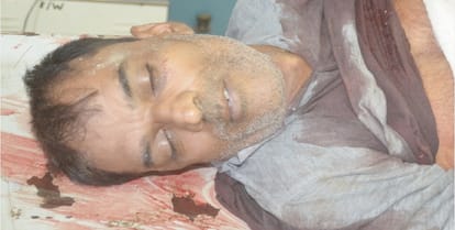Yogiraj does not stop crime, shot the farmer