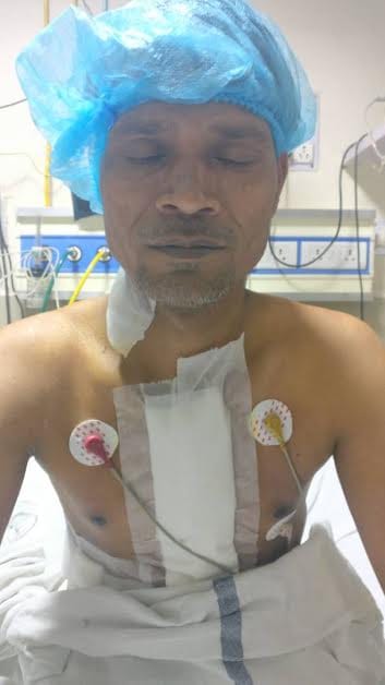 Unique Open Heart Surgery at Sawai Man Singh Hospital