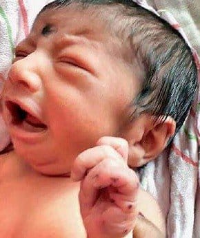 two mail nurse apo after mice rubbed a new born baby in mg hospital 