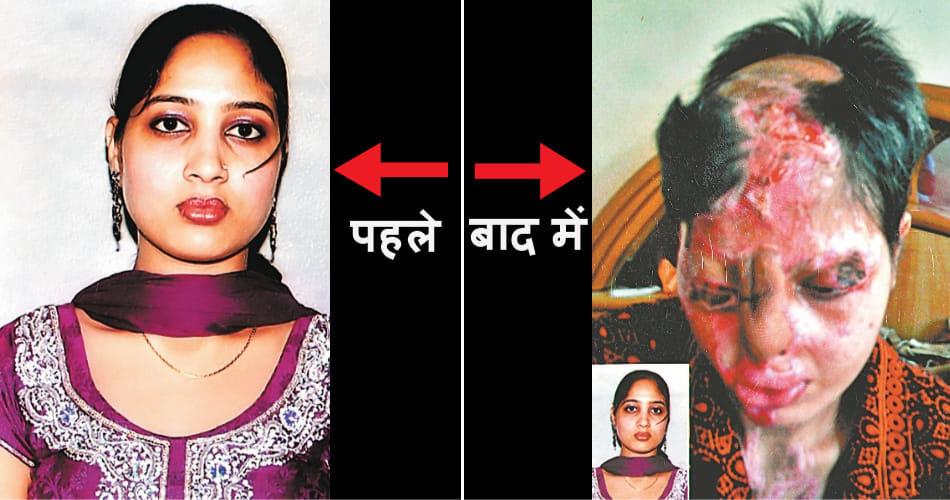 women's day, bathinda acid attack survivor amanpreet