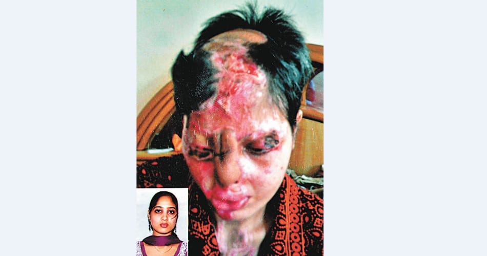 women's day, bathinda acid attack survivor amanpreet