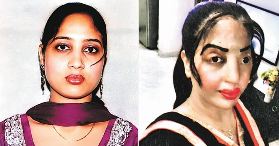bathinda acid attack, acid attack victim amanpreet
