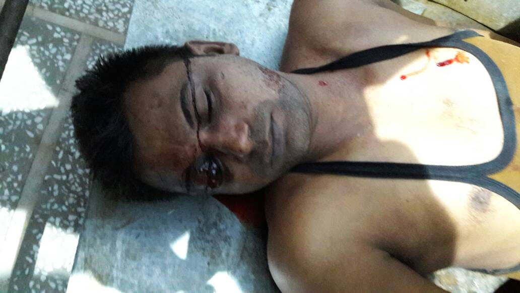 Fatehabad double murder, 7 injured and 1 is serious