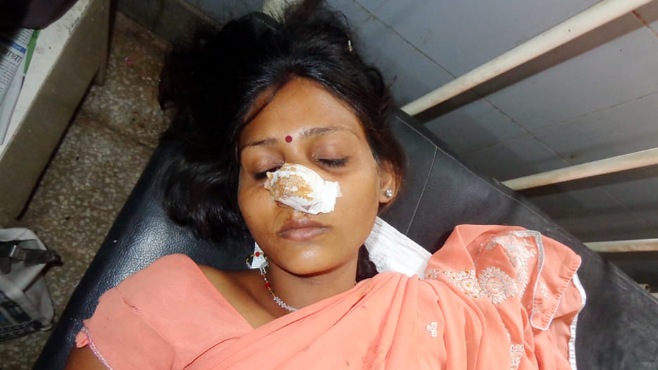 husband cut nose of his wife