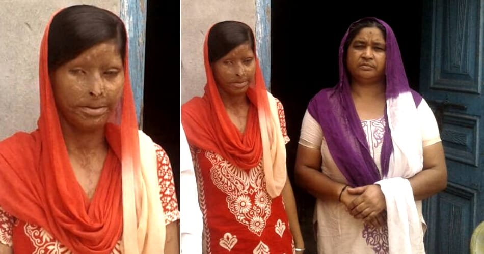 punjab ludhiana acid attack victim rajwant kaur story