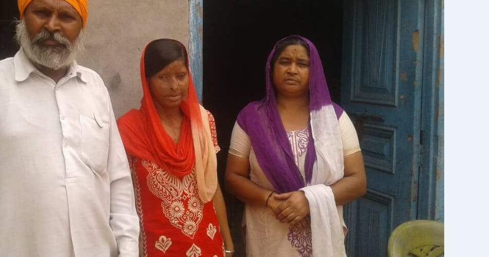 acid attack victim rajwant kaur, Ludhiana acid attack