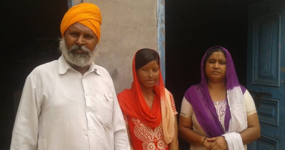 acid attack victim rajwant kaur, Ludhiana acid attack