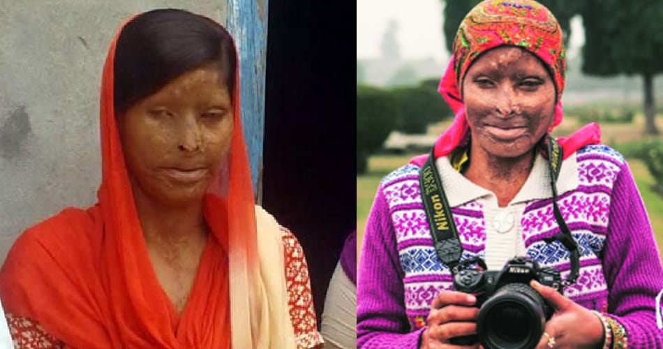 punjab ludhiana acid attack victim rajwant kaur story