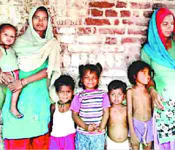 child,s death by measles, 18 children sick