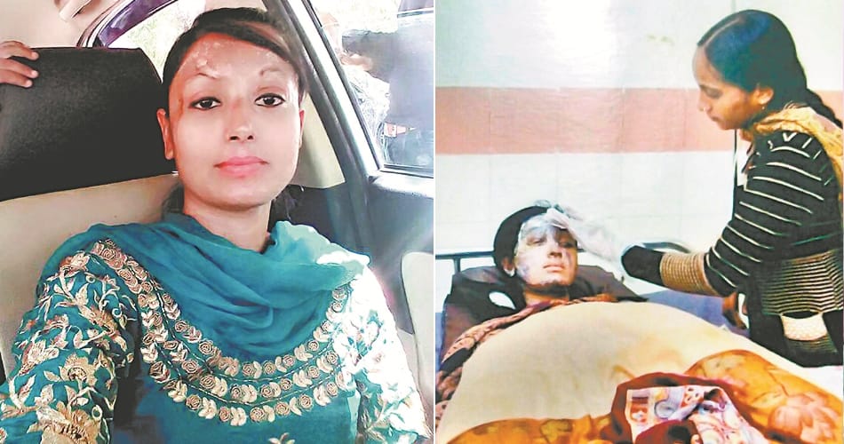 Story of an acid attack victim, Kapurthala daljeet kaur