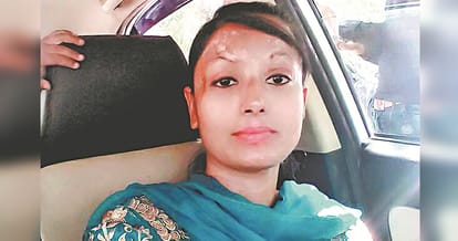 Story of an acid attack victim, Kapurthala daljeet kaur