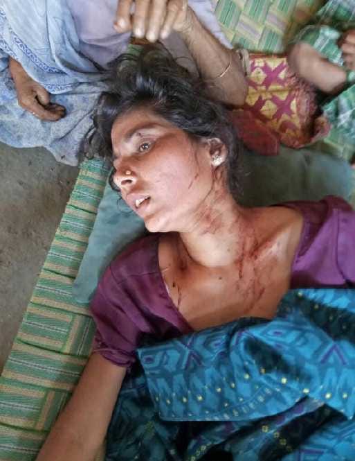 Woman injured by beating with banka
