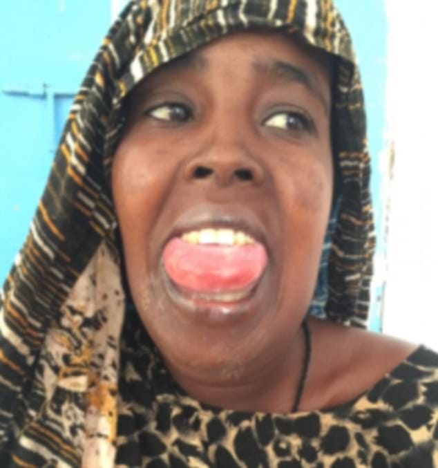 Ethiopian  woman bitten by a viper after catching germs from its MOUTH