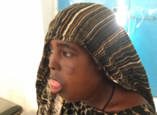 Ethiopian  woman bitten by a viper after catching germs from its MOUTH
