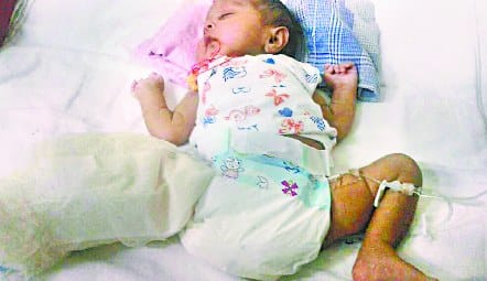 Finally cut the child's leg