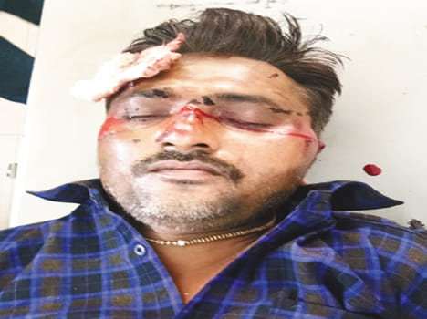 in accident two injured