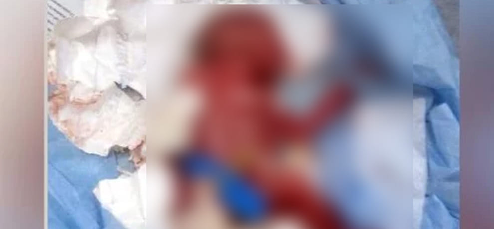 ultimately kid died after thirty hour struggle for life in delhi