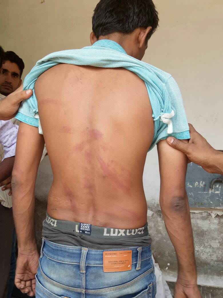 prisoner opened illegal recovery in barmer jail infront of magistrate 