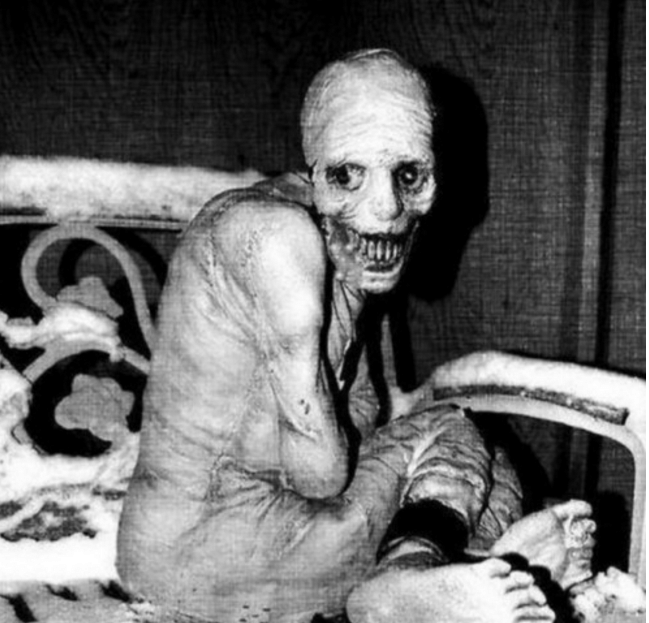 Strange results of sleep deprivation experiment on 5 prisoners